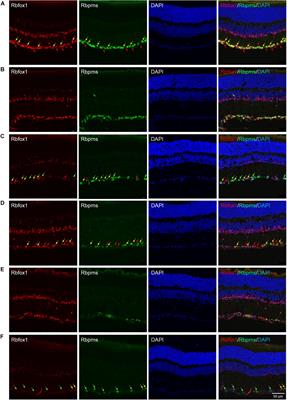 Loss of Rbfox1 Does Not Affect Survival of Retinal Ganglion Cells Injured by Optic Nerve Crush